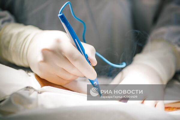 Операция по удалению злокачественной опухоли