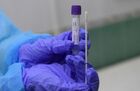 "Гемотест" начинает делать анализы на коронавирусную инфекцию